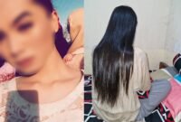 (Kiri) Tangkapan layar dari unggahan media sosial yang beredar. (Kanan) Kondisi Deni alisa Dea Lipa, Senin (10/11/2025). Foto: Dok. Istimewa