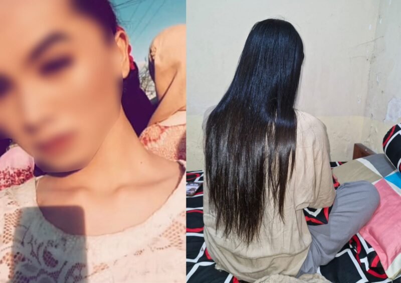 (Kiri) Tangkapan layar dari unggahan media sosial yang beredar. (Kanan) Kondisi Deni alisa Dea Lipa, Senin (10/11/2025). Foto: Dok. Istimewa